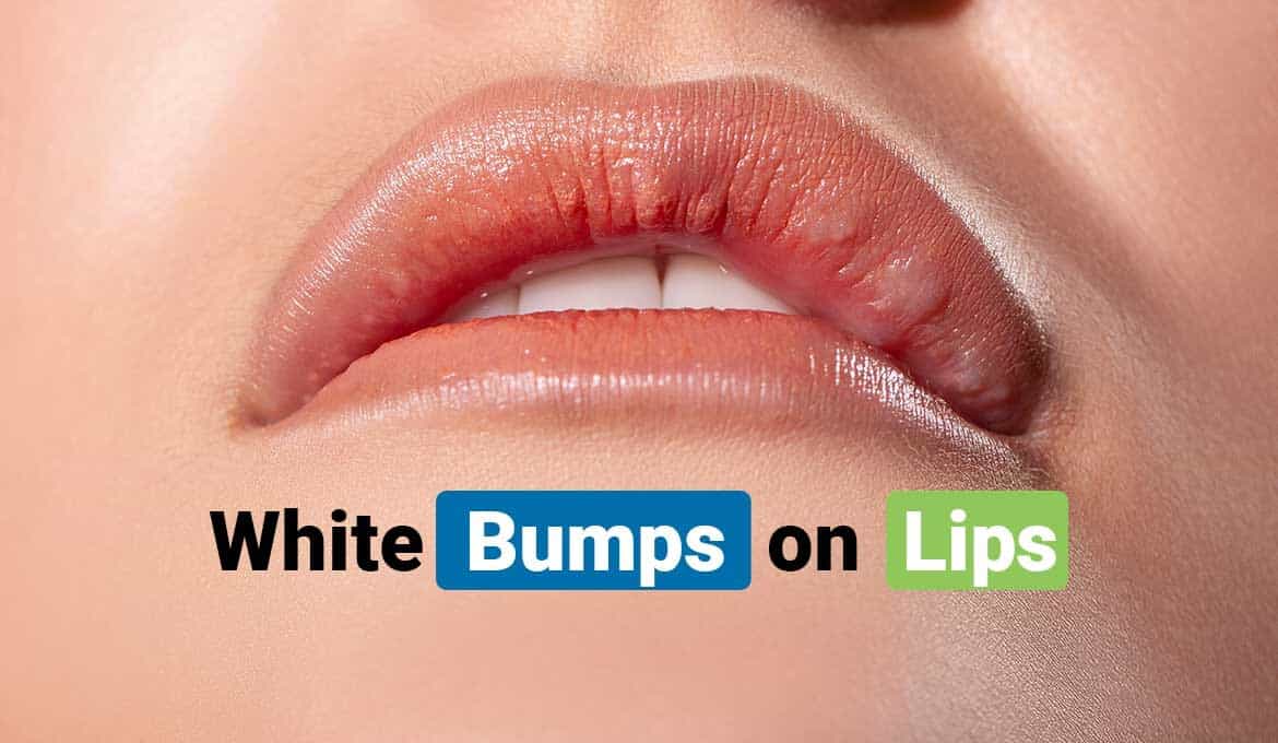 Factors That Cause Tiny White Bumps On Lips Healthy Active
