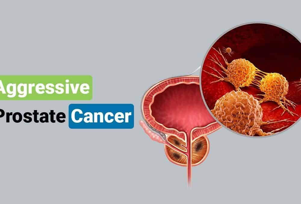How Fast Does Aggressive Prostate Cancer Grow
