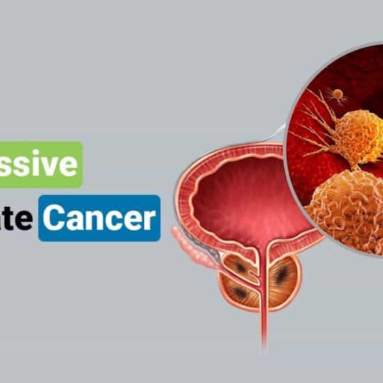 How Fast Does Aggressive Prostate Cancer Grow
