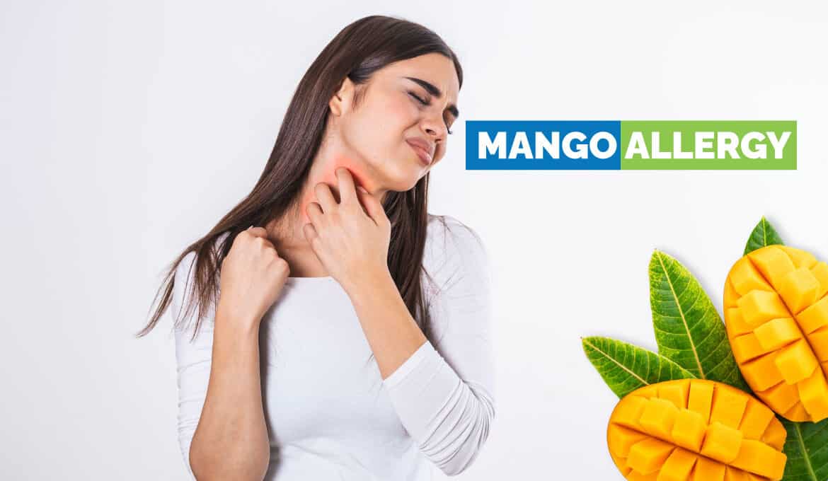 mango allergy