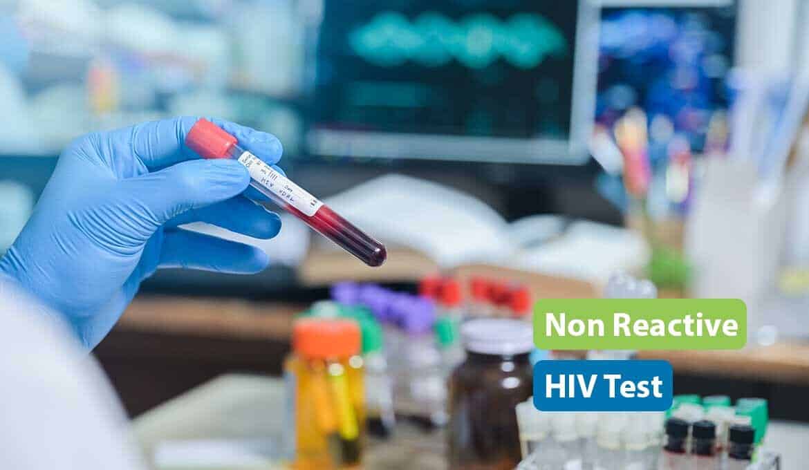 non reactive hiv test