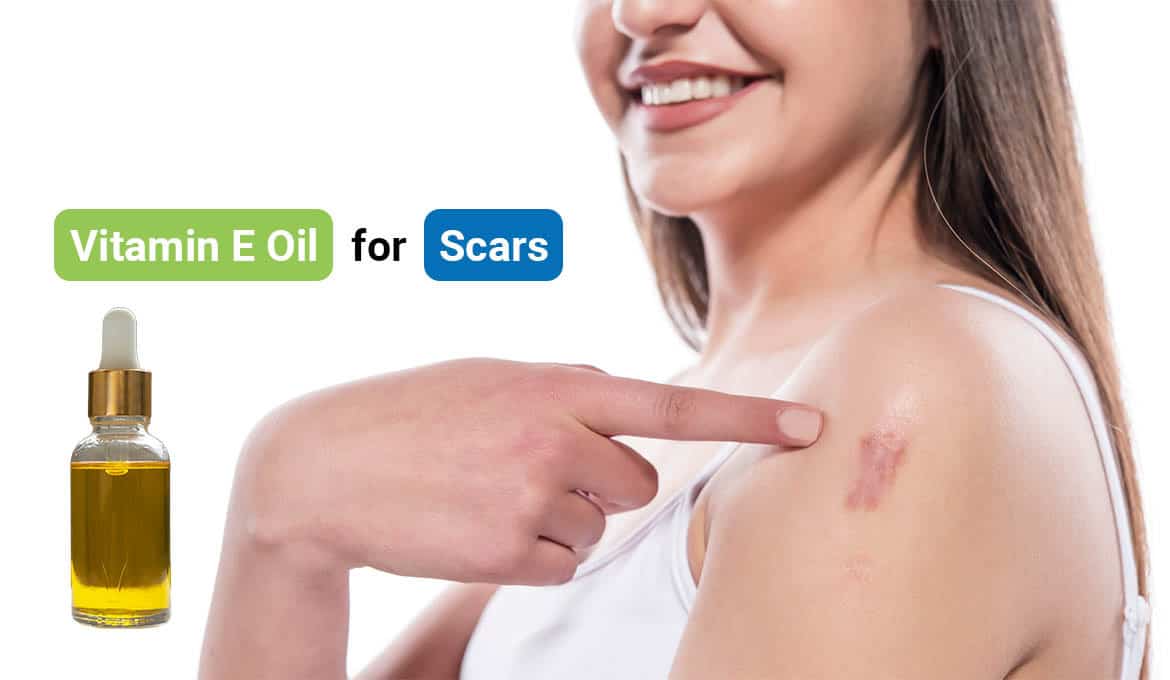 vitamin e oil for scars