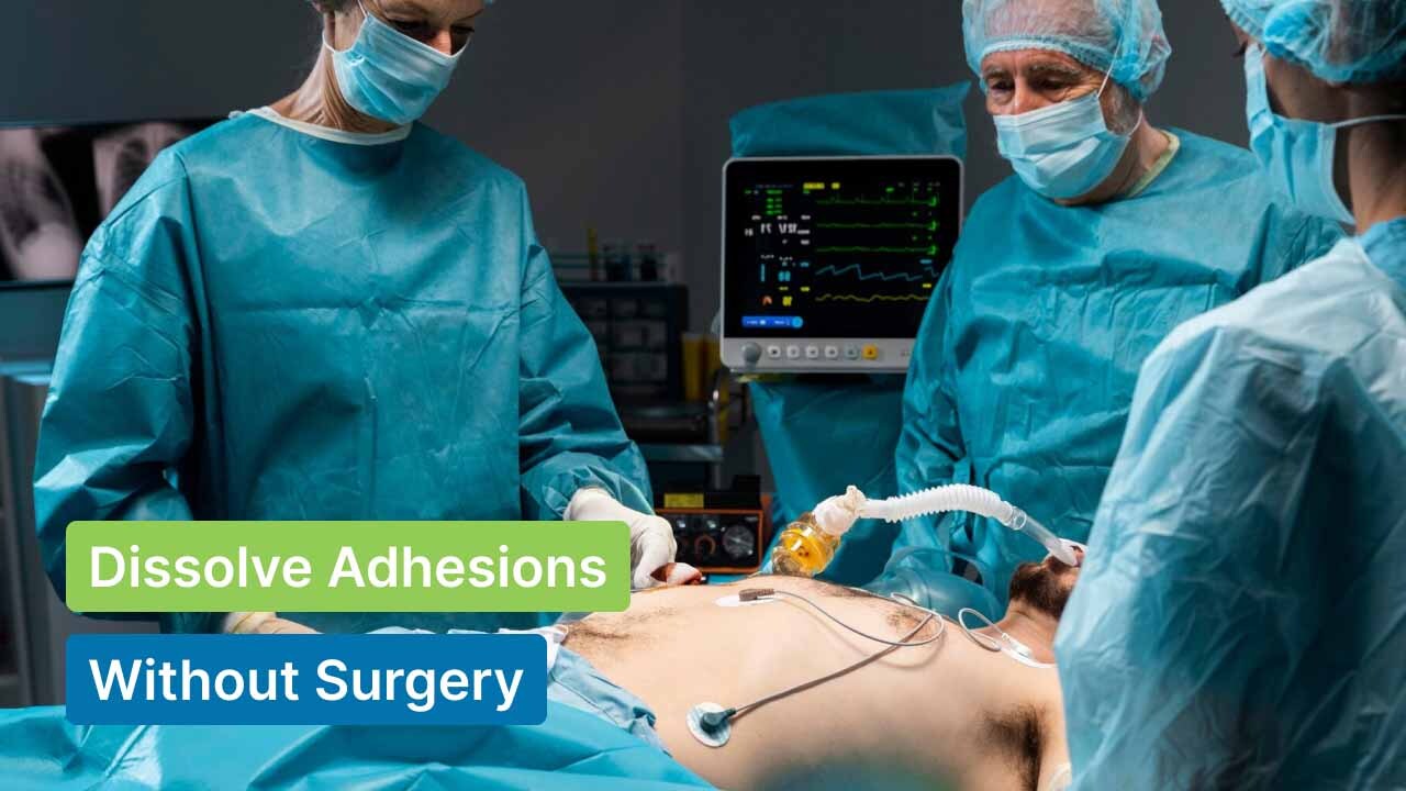 How to Dissolve Adhesions Without Surgery
